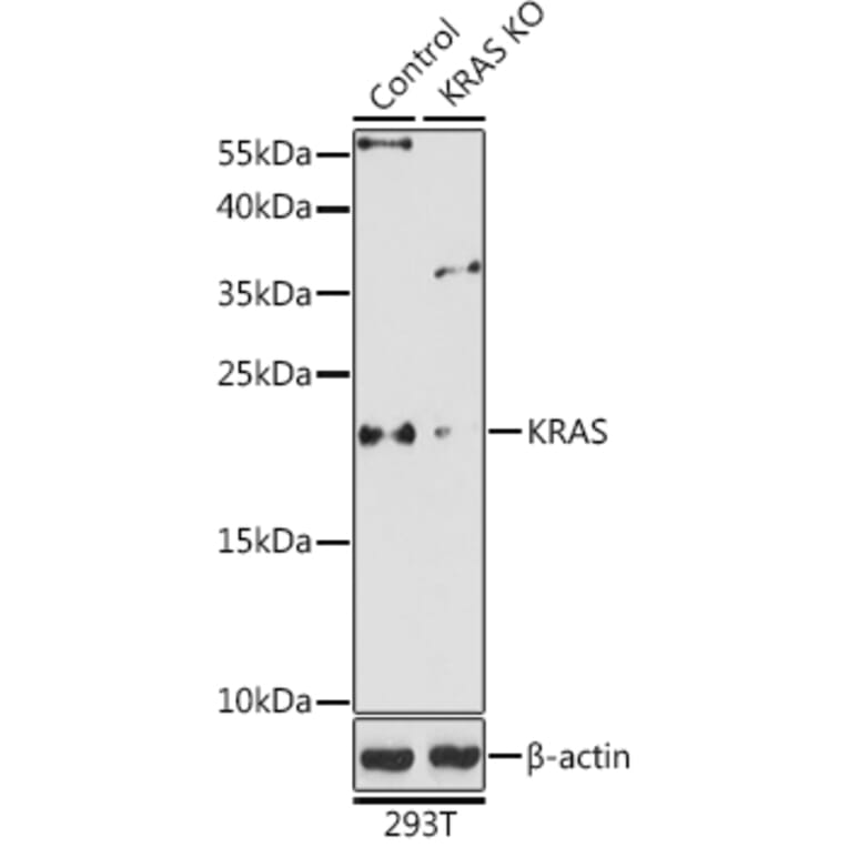 Western Blot - Anti-KRAS Antibody (A93164) - Antibodies.com