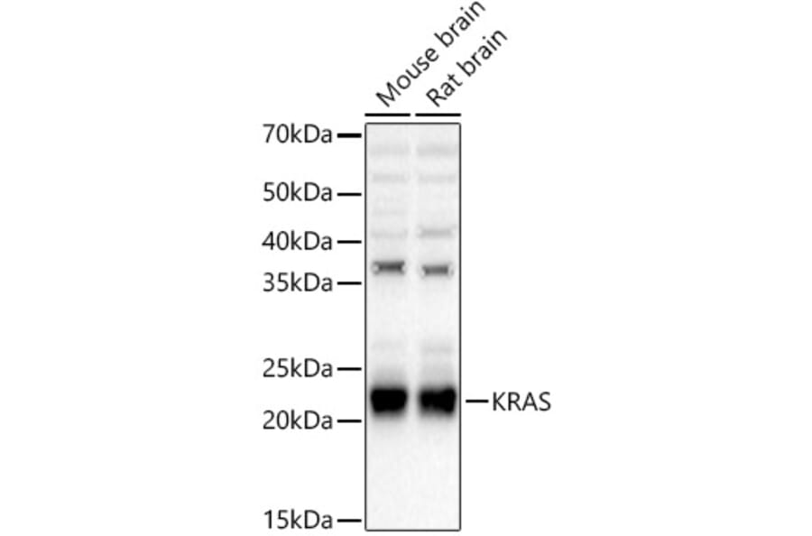 Western Blot - Anti-KRAS Antibody (A93164) - Antibodies.com