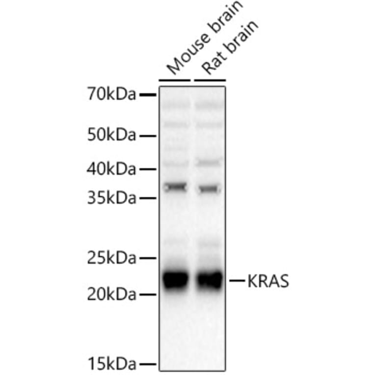 Western Blot - Anti-KRAS Antibody (A93164) - Antibodies.com