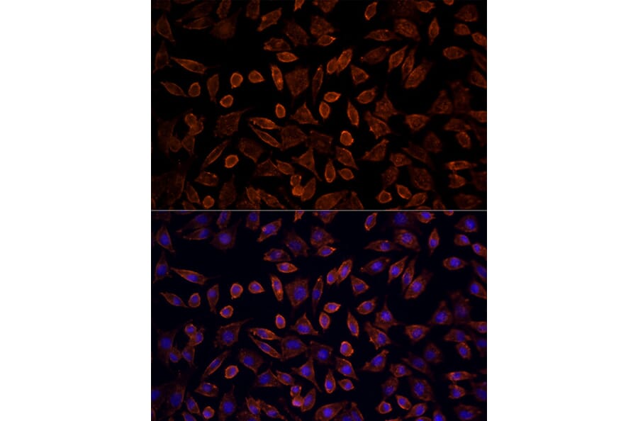 Immunofluorescence - Anti-KRAS Antibody (A93164) - Antibodies.com