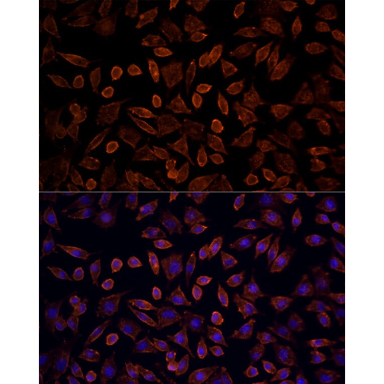 Immunofluorescence - Anti-KRAS Antibody (A93164) - Antibodies.com
