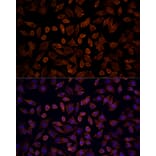 Immunofluorescence - Anti-KRAS Antibody (A93164) - Antibodies.com
