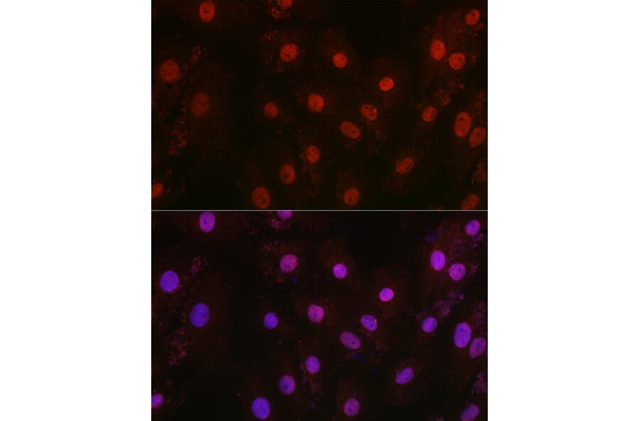 Immunofluorescence - Anti-HIF1 beta Antibody (A93165) - Antibodies.com