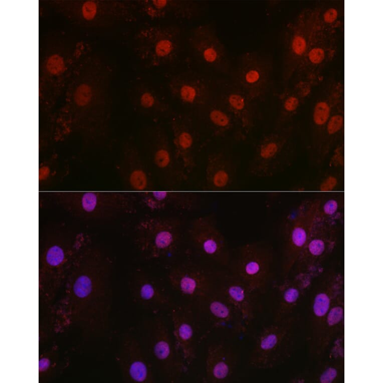 Immunofluorescence - Anti-HIF1 beta Antibody (A93165) - Antibodies.com