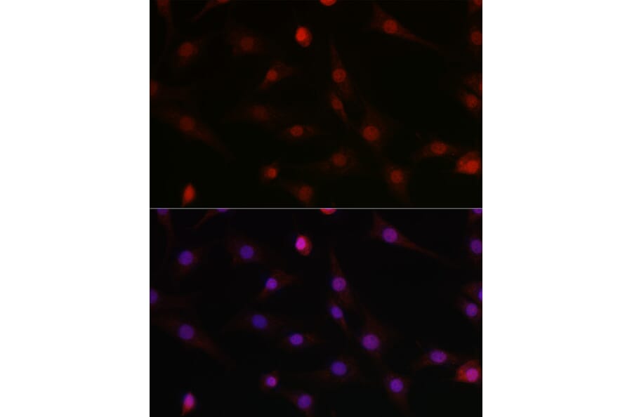 Immunofluorescence - Anti-HIF1 beta Antibody (A93165) - Antibodies.com