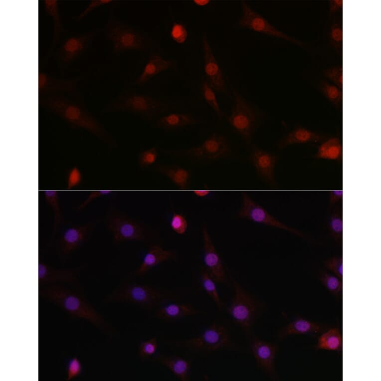Immunofluorescence - Anti-HIF1 beta Antibody (A93165) - Antibodies.com