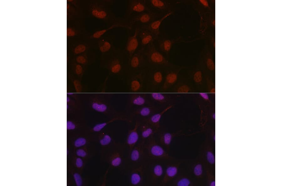 Immunofluorescence - Anti-HIF1 beta Antibody (A93165) - Antibodies.com