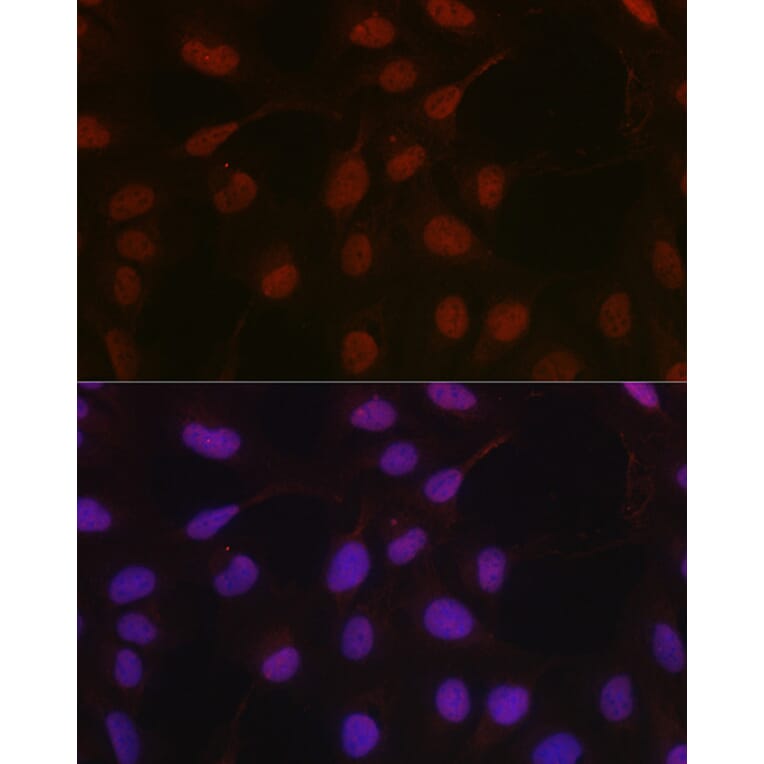 Immunofluorescence - Anti-HIF1 beta Antibody (A93165) - Antibodies.com