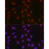 Immunofluorescence - Anti-HIF1 beta Antibody (A93165) - Antibodies.com