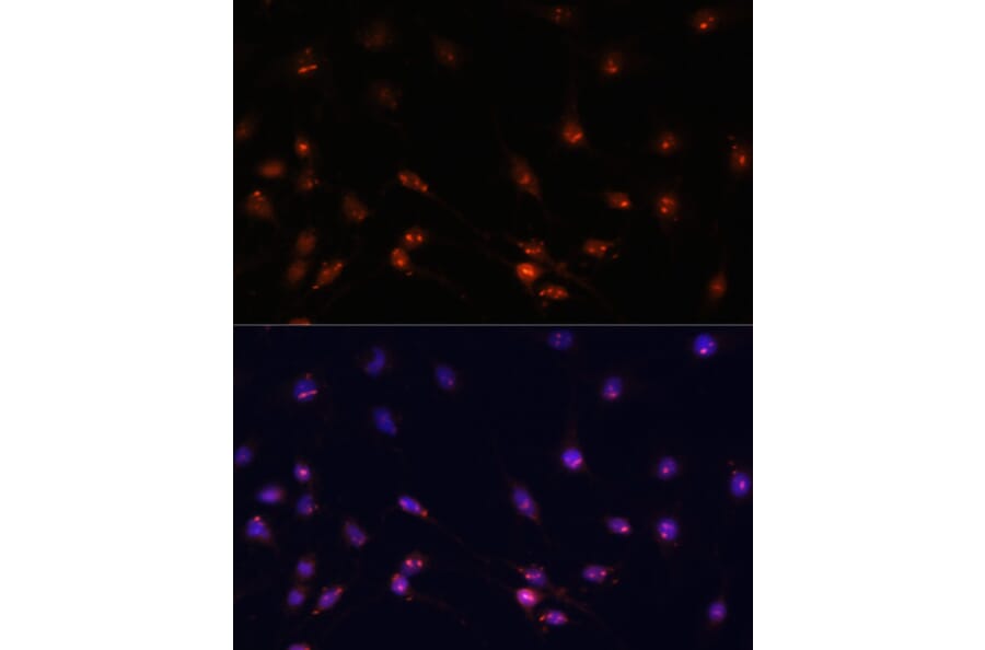 Immunofluorescence - Anti-ATR Antibody (A93166) - Antibodies.com