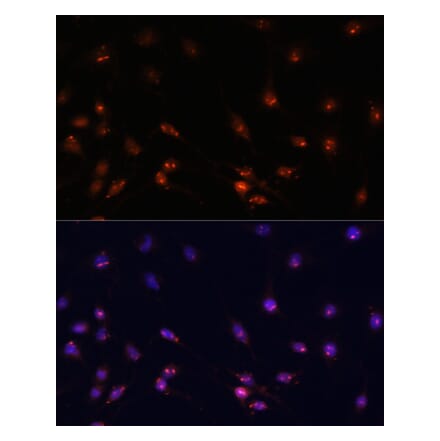 Immunofluorescence - Anti-ATR Antibody (A93166) - Antibodies.com