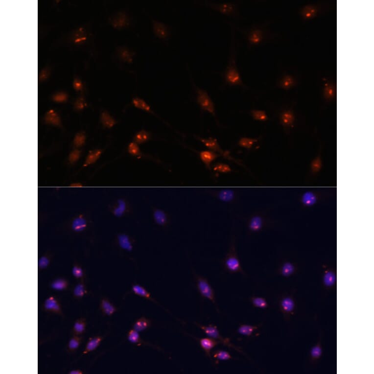 Immunofluorescence - Anti-ATR Antibody (A93166) - Antibodies.com
