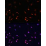 Immunofluorescence - Anti-ATR Antibody (A93166) - Antibodies.com