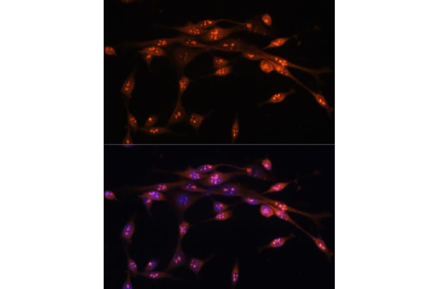 Immunofluorescence - Anti-ATR Antibody (A93166) - Antibodies.com