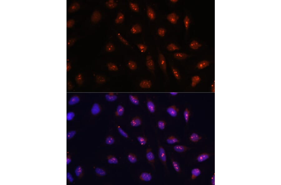 Immunofluorescence - Anti-ATR Antibody (A93166) - Antibodies.com