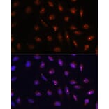 Immunofluorescence - Anti-ATR Antibody (A93166) - Antibodies.com