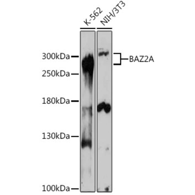Western Blot - Anti-BAZ2A/TIP5 Antibody (A93167) - Antibodies.com