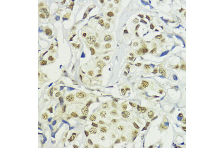 Immunohistochemistry - Anti-BAZ2A/TIP5 Antibody (A93167) - Antibodies.com