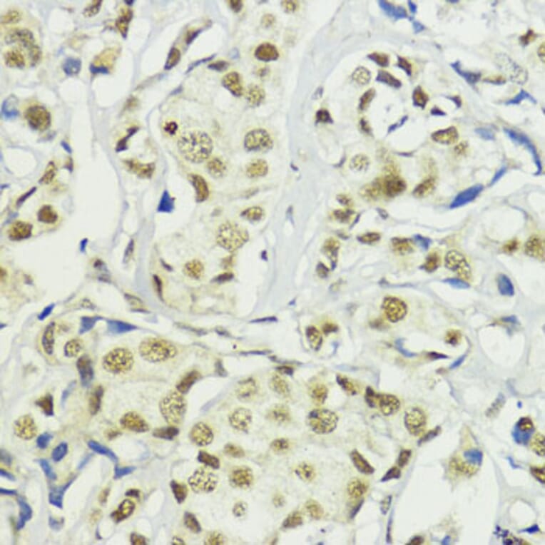Immunohistochemistry - Anti-BAZ2A/TIP5 Antibody (A93167) - Antibodies.com