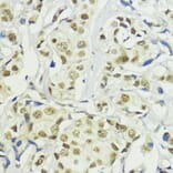 Immunohistochemistry - Anti-BAZ2A/TIP5 Antibody (A93167) - Antibodies.com