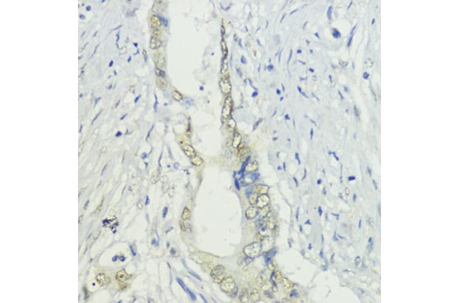 Immunohistochemistry - Anti-BAZ2A/TIP5 Antibody (A93167) - Antibodies.com