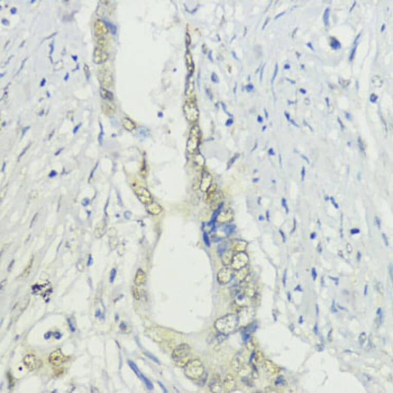 Immunohistochemistry - Anti-BAZ2A/TIP5 Antibody (A93167) - Antibodies.com