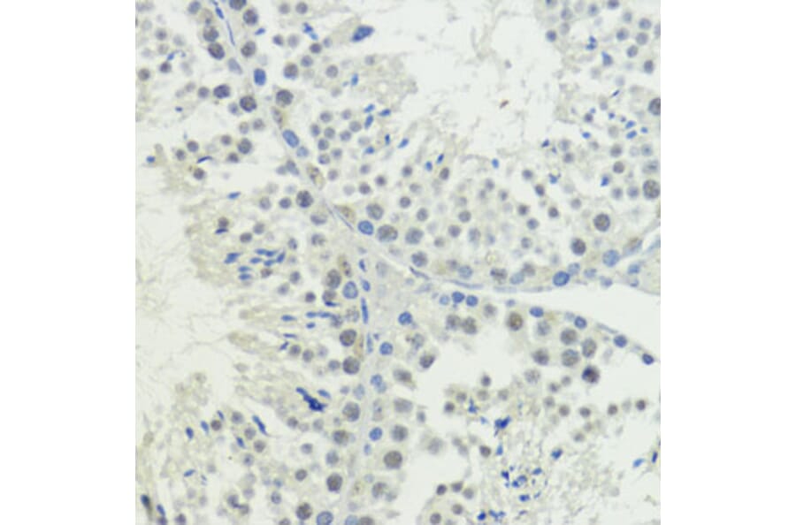 Immunohistochemistry - Anti-BAZ2A/TIP5 Antibody (A93167) - Antibodies.com