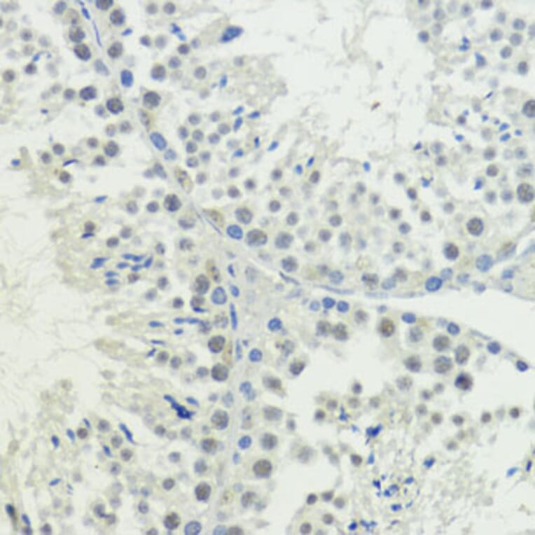 Immunohistochemistry - Anti-BAZ2A/TIP5 Antibody (A93167) - Antibodies.com