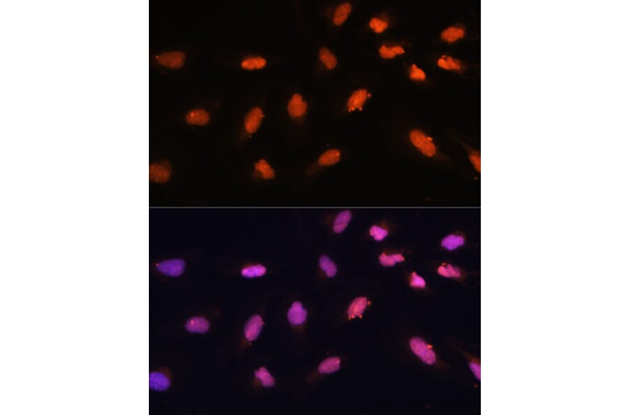 Immunofluorescence - Anti-BAZ2A/TIP5 Antibody (A93167) - Antibodies.com