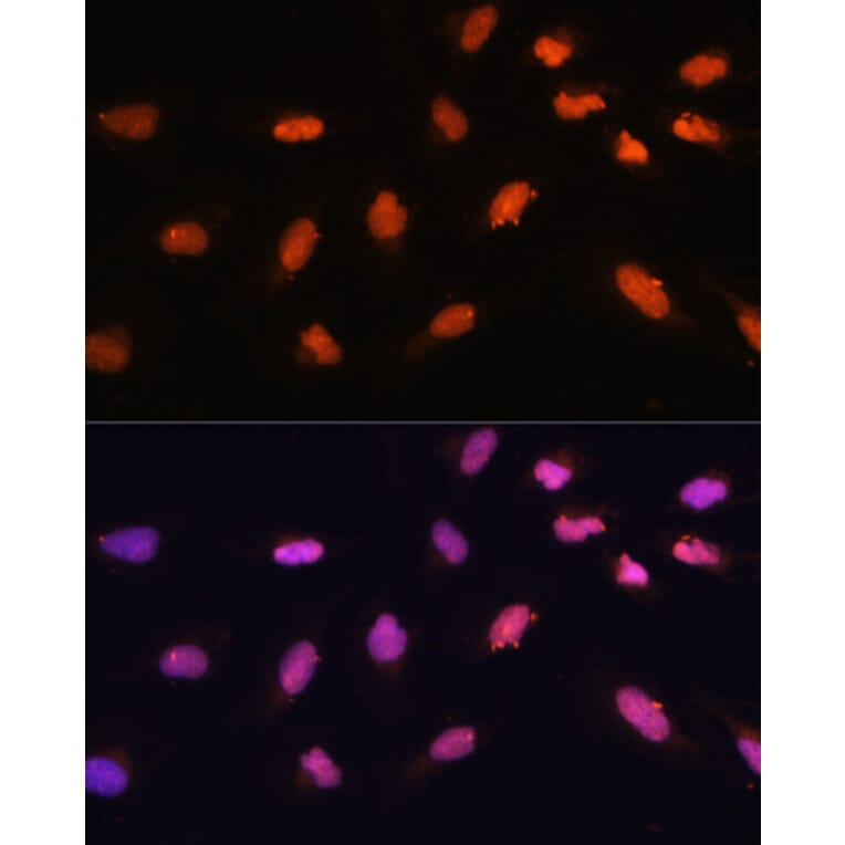 Immunofluorescence - Anti-BAZ2A/TIP5 Antibody (A93167) - Antibodies.com