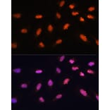 Immunofluorescence - Anti-BAZ2A/TIP5 Antibody (A93167) - Antibodies.com