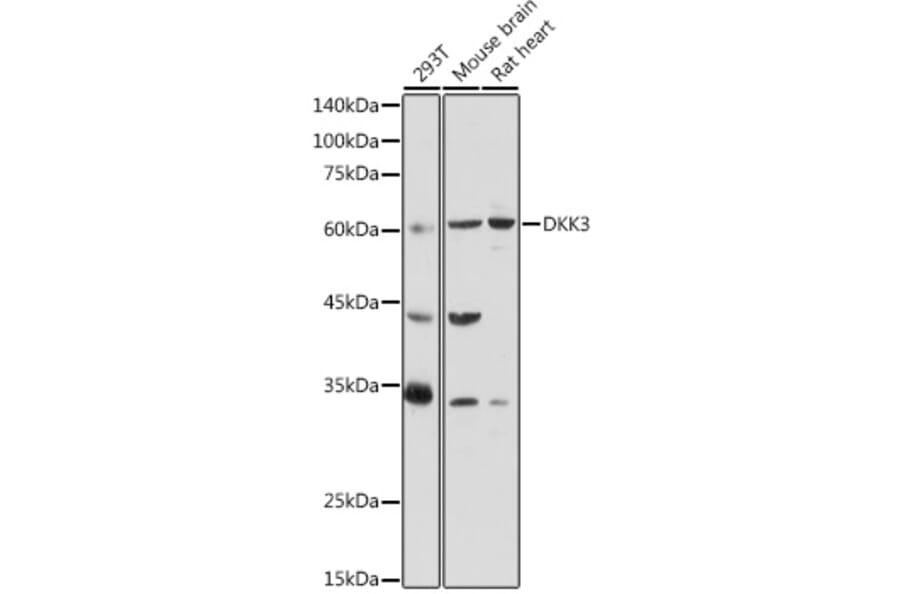 Western Blot - Anti-Dkk3 Antibody (A93168) - Antibodies.com