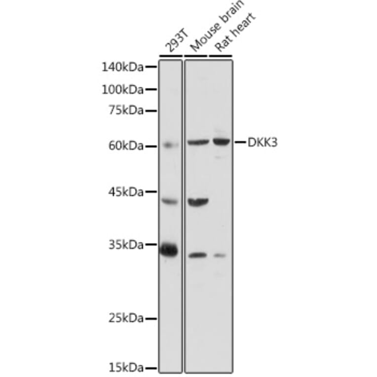 Western Blot - Anti-Dkk3 Antibody (A93168) - Antibodies.com