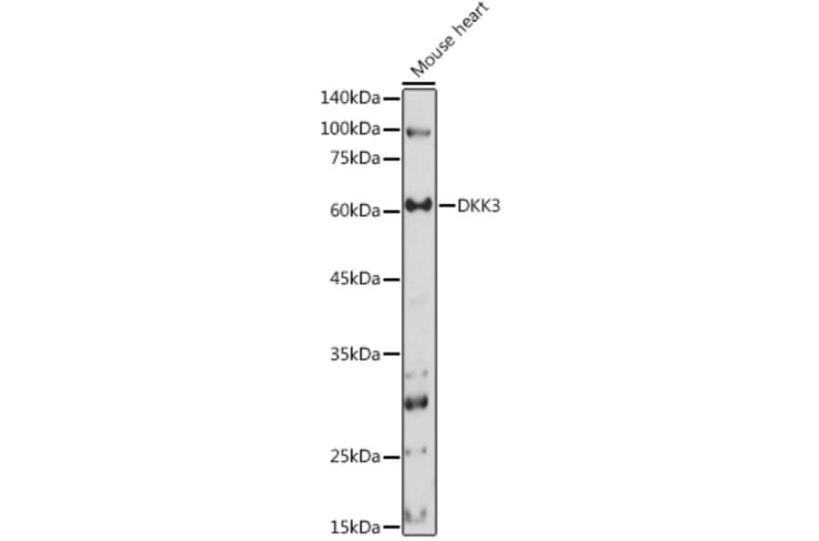 Western Blot - Anti-Dkk3 Antibody (A93168) - Antibodies.com