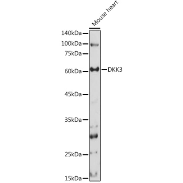 Western Blot - Anti-Dkk3 Antibody (A93168) - Antibodies.com