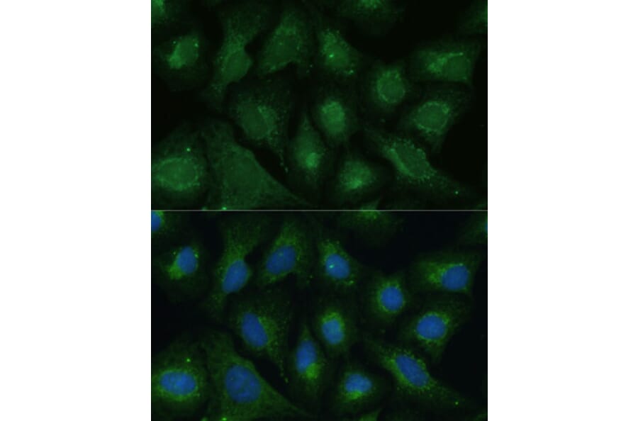 Immunofluorescence - Anti-Dkk3 Antibody (A93168) - Antibodies.com