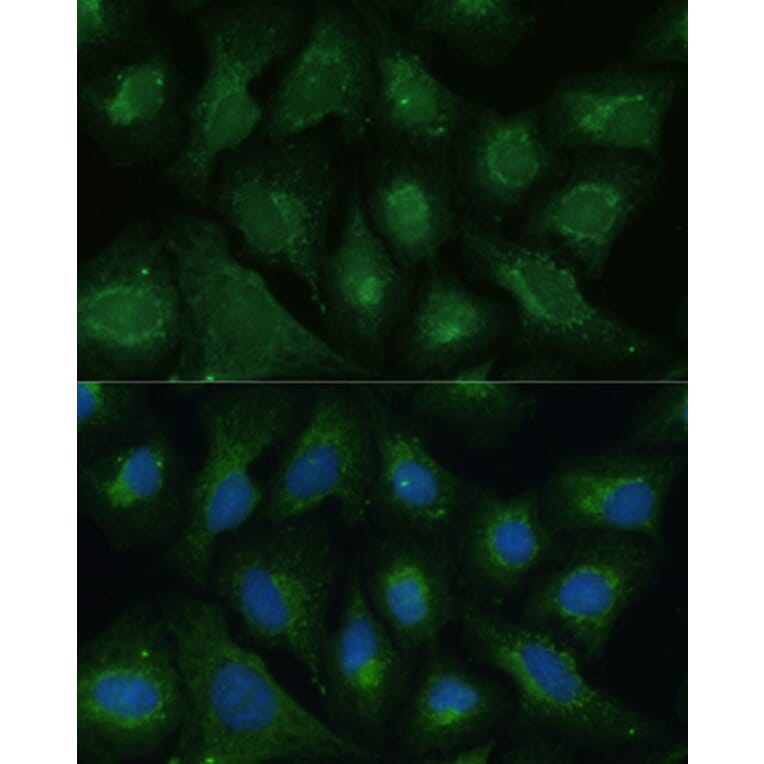 Immunofluorescence - Anti-Dkk3 Antibody (A93168) - Antibodies.com