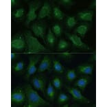 Immunofluorescence - Anti-Dkk3 Antibody (A93168) - Antibodies.com