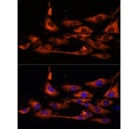 Immunofluorescence - Anti-ACOX3 Antibody (A93170) - Antibodies.com