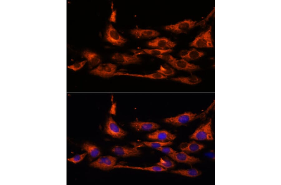Immunofluorescence - Anti-ACOX3 Antibody (A93170) - Antibodies.com