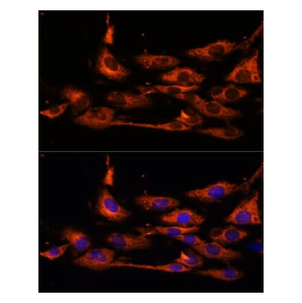 Immunofluorescence - Anti-ACOX3 Antibody (A93170) - Antibodies.com