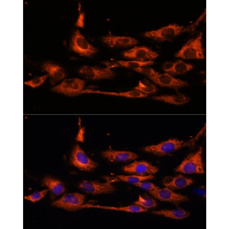 Immunofluorescence - Anti-ACOX3 Antibody (A93170) - Antibodies.com