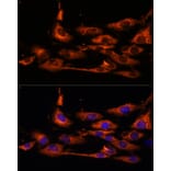 Immunofluorescence - Anti-ACOX3 Antibody (A93170) - Antibodies.com