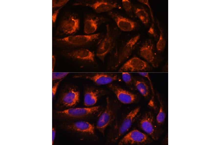 Immunofluorescence - Anti-ACOX3 Antibody (A93170) - Antibodies.com