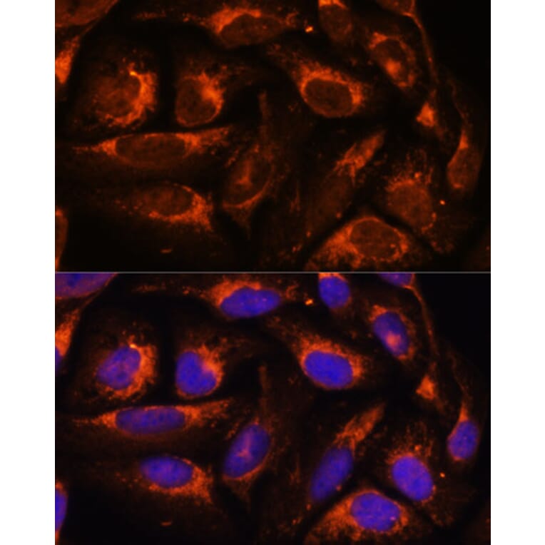 Immunofluorescence - Anti-ACOX3 Antibody (A93170) - Antibodies.com