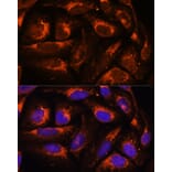 Immunofluorescence - Anti-ACOX3 Antibody (A93170) - Antibodies.com