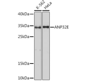 Western Blot - Anti-ANP32E Antibody (A93172) - Antibodies.com