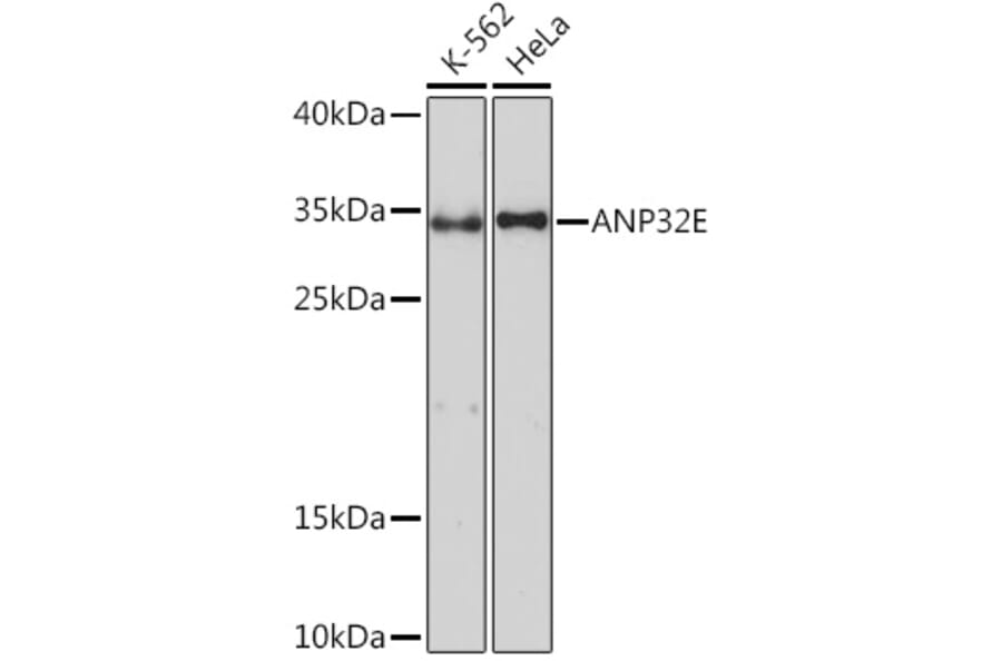 Western Blot - Anti-ANP32E Antibody (A93172) - Antibodies.com