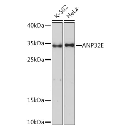 Western Blot - Anti-ANP32E Antibody (A93172) - Antibodies.com