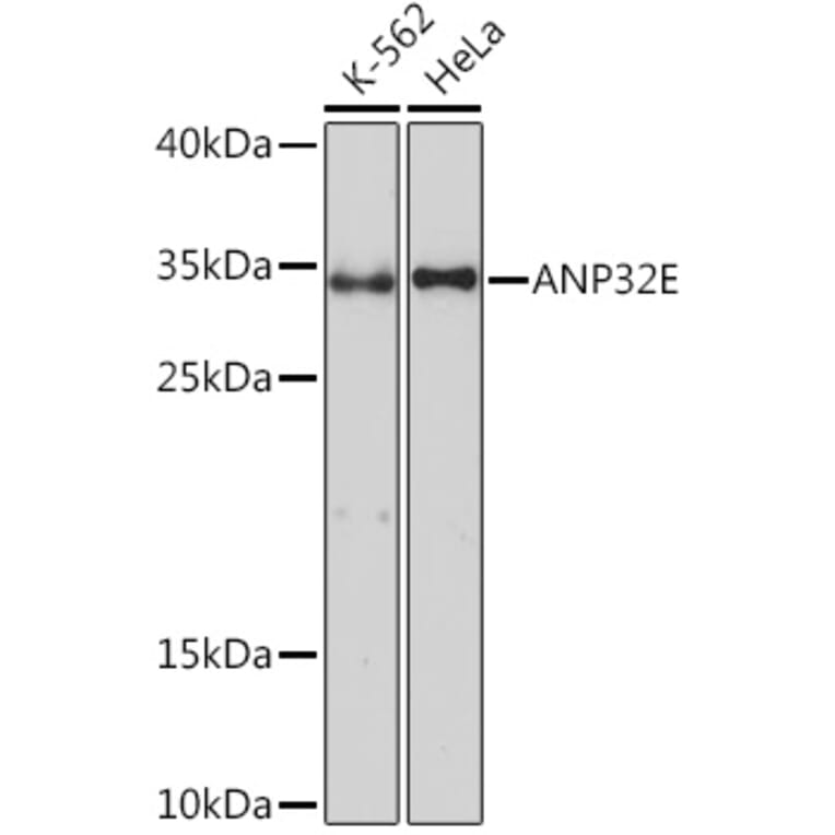 Western Blot - Anti-ANP32E Antibody (A93172) - Antibodies.com